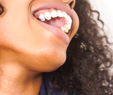 Clínicas Invisalign en Madrid