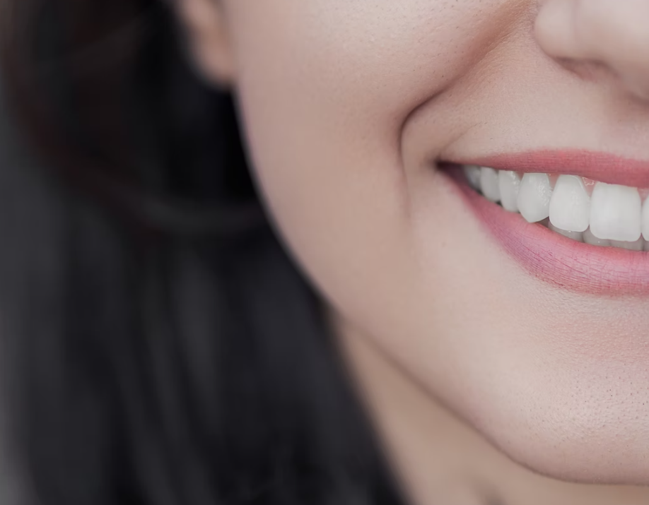 El mejor blanqueamiento de dientes en Madrid