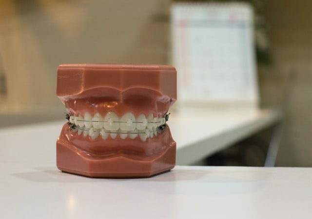 ¿Fundas transparentes para dientes o brackets?