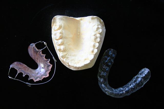 Alineadores y ortodoncia invisible. ¡Todo lo que debes saber!