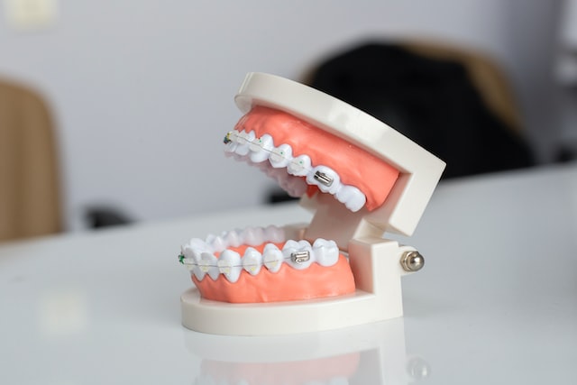 ¿Cuál es la ortodoncia más rápida y efectiva?