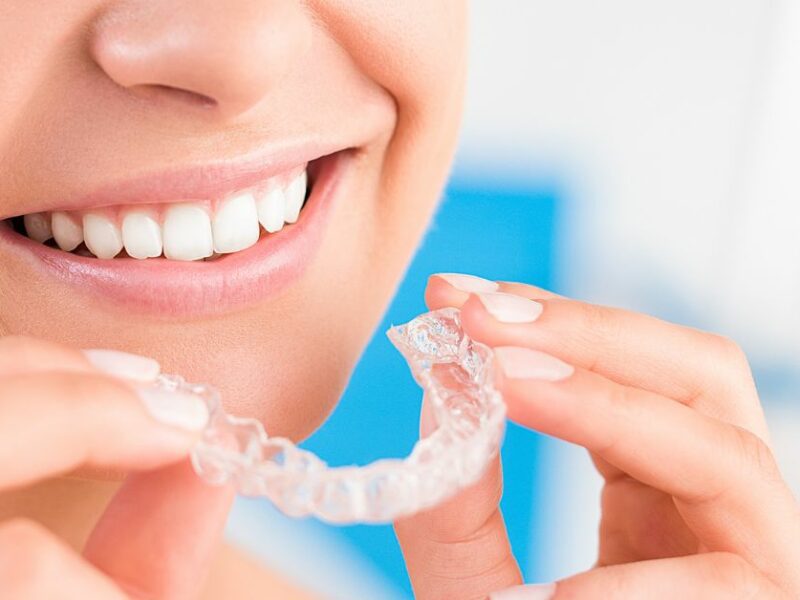 ¿Qué precio tiene Invisalign en 2023?