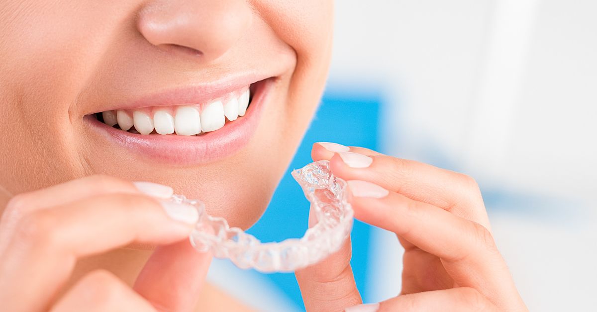 ¿Qué precio tiene Invisalign en 2023?